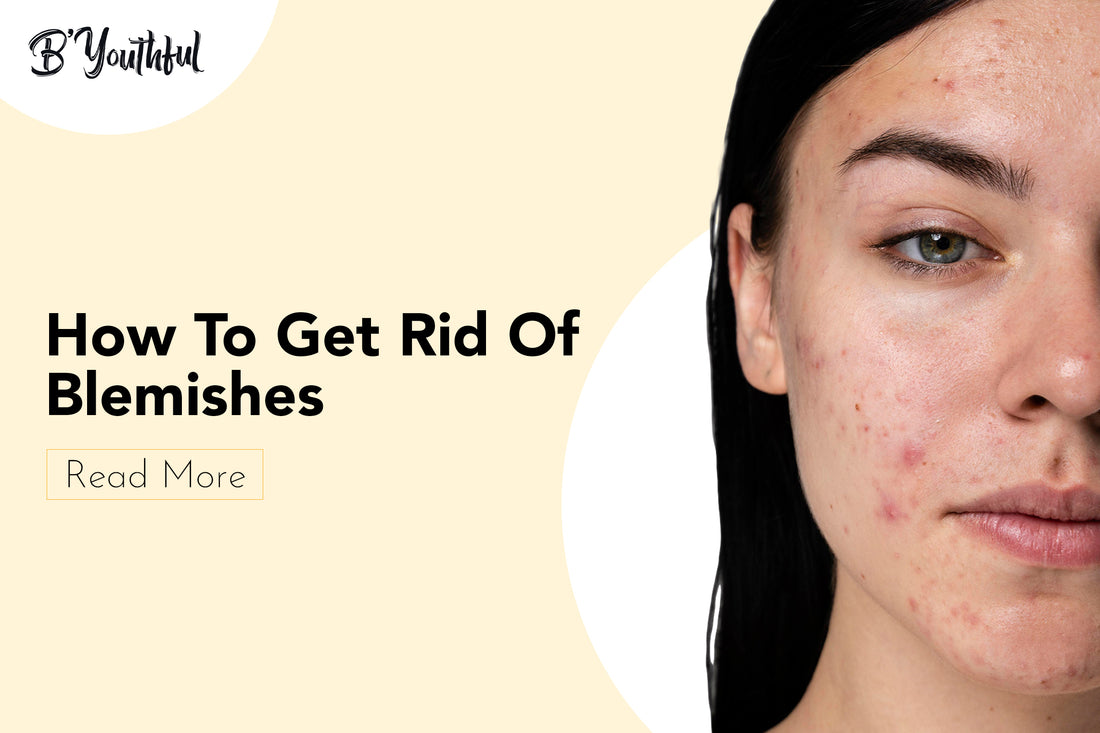 Bye Bye Blemishes Combo: Clear Skin